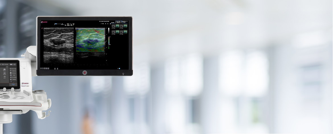 mylab9-ultrasound-home_09